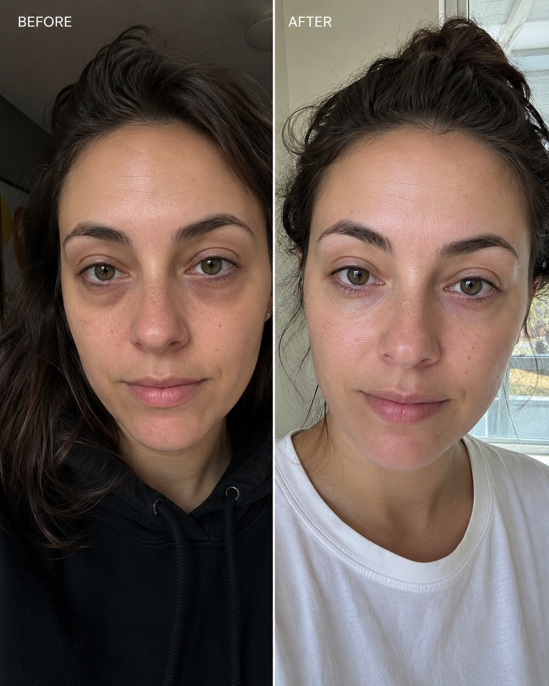 Tanya W. before and after