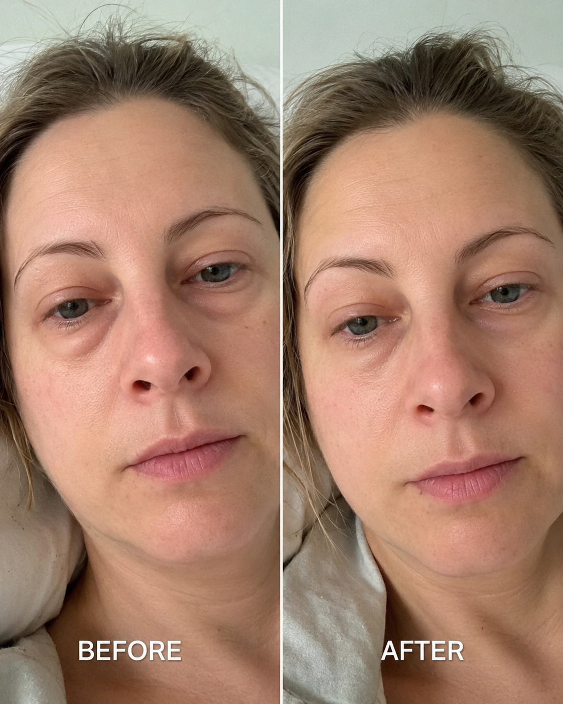 Karen L. before and after