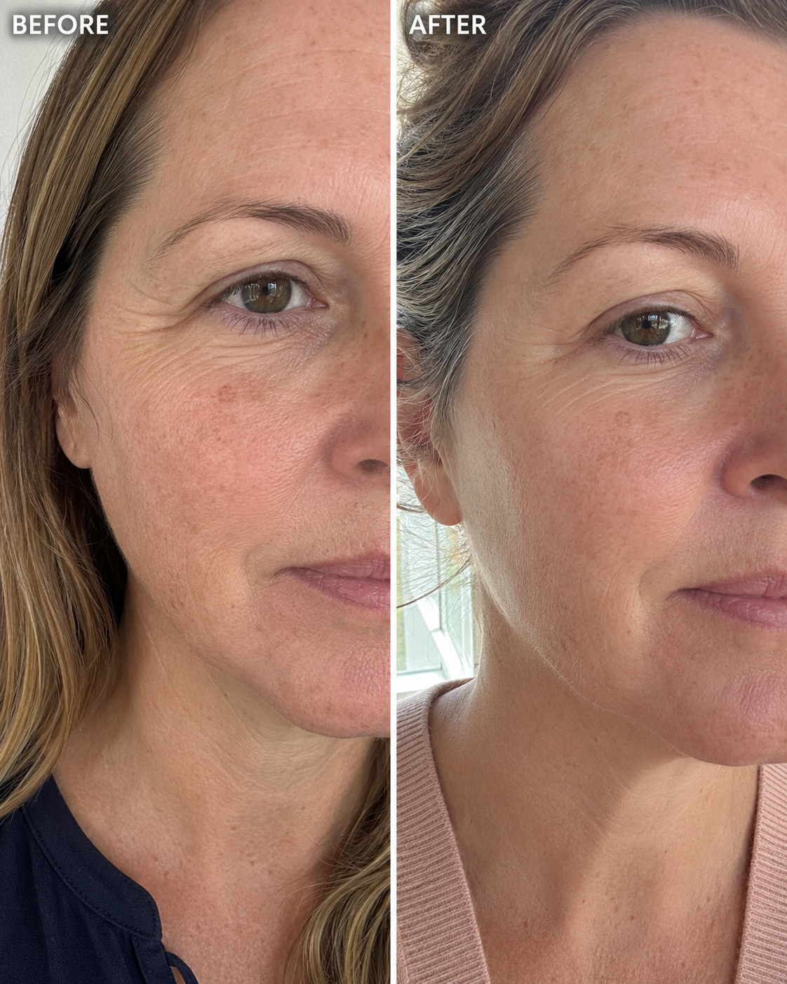 Megan P. before and after