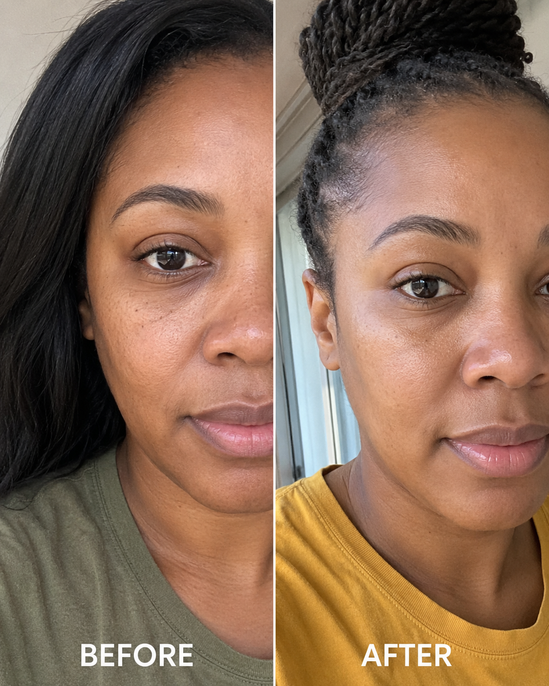 Diana R. before and after